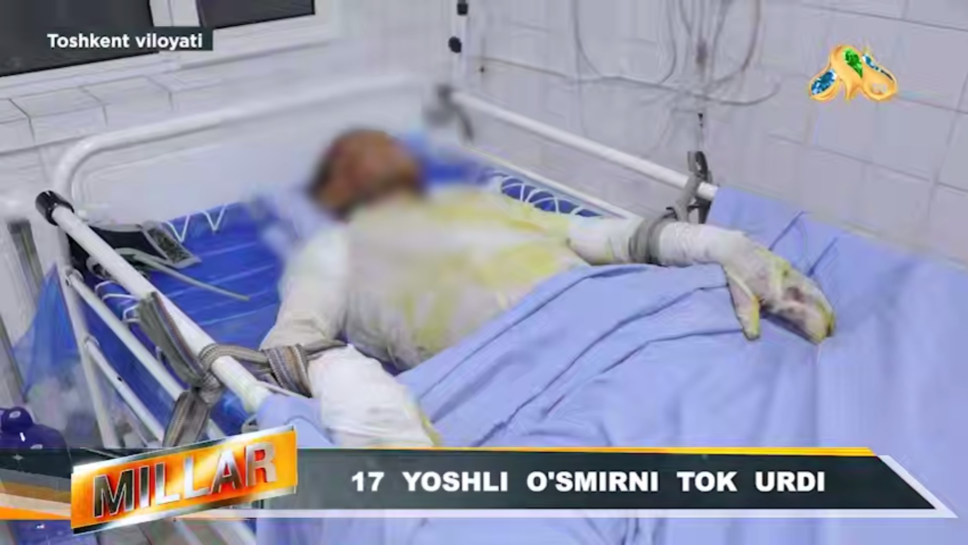 Chirchiqda vagon ustida selfi qilmoqchi bo‘lgan o‘smirni tok urdi