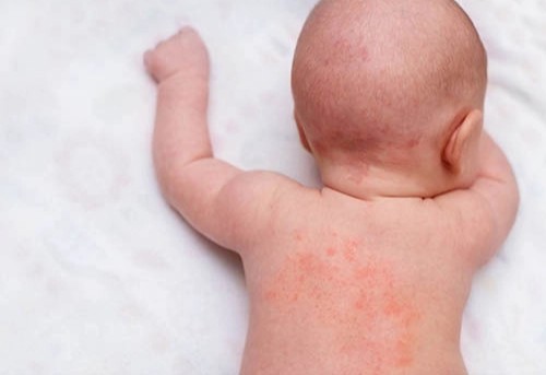 Tukli katta dildo porno