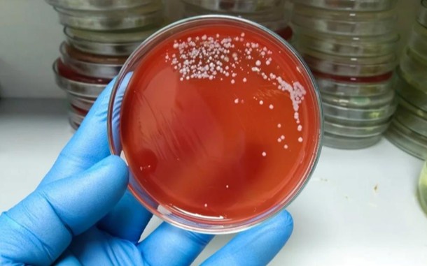 Ogizdagi kontur onlayn