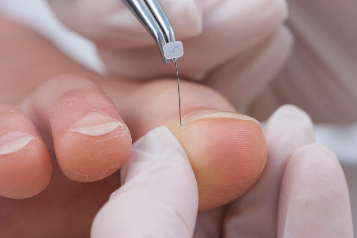 Erkaklar jinsiy olatni onanizm video