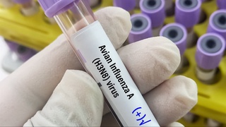 Xitoyda parranda grippidan ilk oʻlim holati qayd etildi