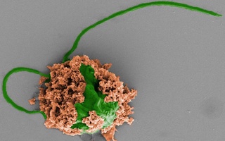 Pnevmoniyani davolovchi mikrorobotlar ishlab chiqildi