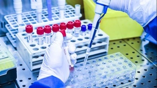 “Яширин штамм”нинг янги белгилари “ошкор” бўлмоқда 