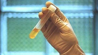 Хитойда одамнинг парранда гриппига чалингани билан боғлиқ яна бир ҳолат аниқланди