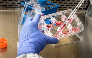 Маймун чечаги аниқланган мамлактлар сони 103 тага етди — ЖССТ