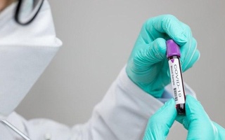 COVID-19 in Uzbekistan: 2746 cases