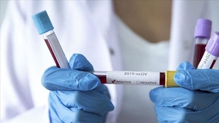 Koronavirus bilan kasallanish boʻyicha kunlik antirekord yana yangilandi