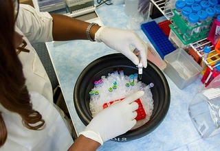 Нерв ҳужайраларини тиклаш усули ишлаб чиқилди