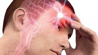 “Cherepnoy davleniya” nima?