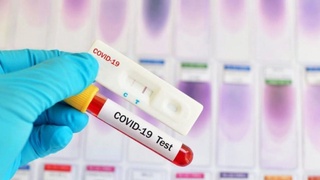 Экспресс-тест на наличие антигена коронавируса для прибывающих в Узбекистан