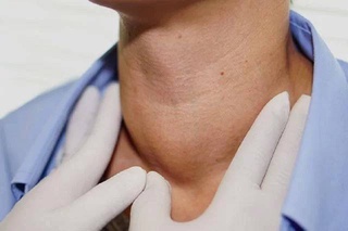Scientists have found that the transferred Covid-19 provokes thyroid diseases