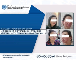 Приняты меры в отношении салона красоты «Estelle» за нанесение ожога кожи лица клиенту