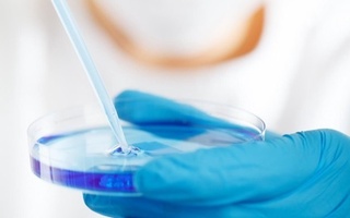 Zambiyada kuydirgi kasalligi avj olmoqda: 330 kishi ushbu kasallikka chalindi