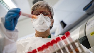 Россияда 800 та лаборатория коронавирус тестини ўтказади