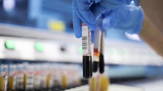 Москва шаҳри ва Москва вилоятида ишлайдиган ўзбекистонликлар COVID-19 синовидан бепул ўтказилади