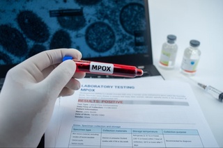 ЖССТ: Дунёда mpox вируси яна фаоллашмоқда