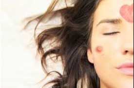 Яраларни билдирмайдиган сунъий тери яратилди