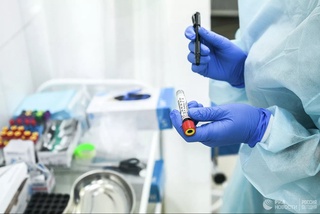 “Ipotekabank”ning Chilonzor tuman filiali va “O‘zbekiston havo yo‘llari” AJ xodimlarida koronavirus aniqlangan