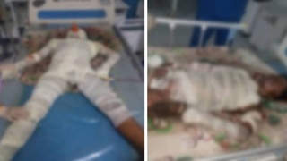 13-летнего парня поднявшегося на крышу вагона, ударило электрическим током высокого напряжения