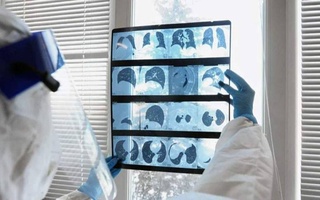 Doctors named diseases that remain after the coronavirus forever