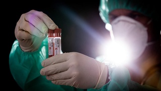 Қирғизистон Ҳукуматининг 26 нафар ходимида коронавирус аниқланди