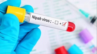 Uzbekistan has temporarily suspended the import of a number of goods from India due to the Nipah virus