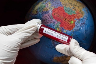 Кеча жаҳон бўйича 813 мингга яқин кишида коронавирус инфекцияси аниқланди