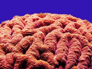 Россиялик олимлар инсультнинг олдини олиш бўйича ноёб усулни таклиф этишди