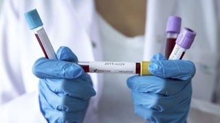 Дунёда бўйича 4 миллиондан ортиқ одам коронавирусга чалинган