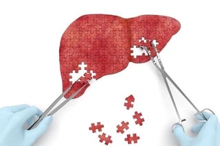 Жигар ёғли дистрофияси индексини аниқловчи дастур яратилди