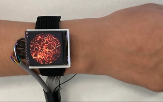 Xitoyda qon tomirlarining ichini ko'rish imkonini beruvchi sensor ishlab chiqildi