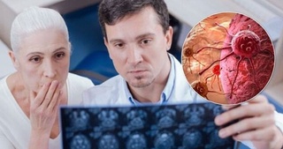 Qaysi odatlar saraton rivojlanishiga olib kelishi mumkin?