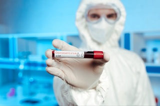 Yurtimizda kunlik kasallanishlar soni ketma-ket uchinchi kun oshdi