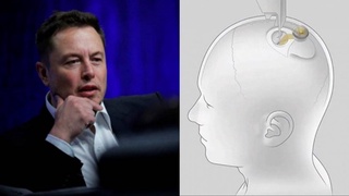 “Neuralink” 2023 йил охирида инсон миясига чипларни жойлаштириш бўйича синовларни бошлайди