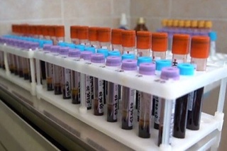 Россия вакцинасини синовдан ўтказгандан сўнг, 100 фоиз кўнгиллиларда иммунитет кузатилган