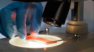 Қон гуруҳи иммунитетга таъсир қиладими?