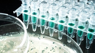 Ўзбекистон инновацион тизимини модернизация қилишга 50 млн доллар ажратилади