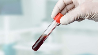 Блоха – и в Калифорнии чума