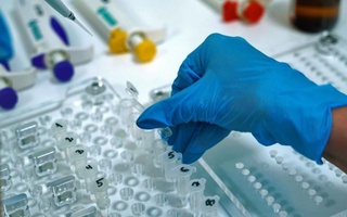 Қирғизистонда метапневмовирус инфекциясига чалиниш билан боғлиқ иккита ҳолат аниқланди