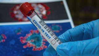 Кунлик касалланишлар сони кескин кўпайди 