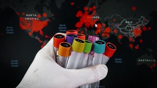 СOVID-19: Yevropada kasallik qayta avj olmoqda