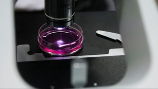 Olimlar saratonni bartaraf etadigan immun hujayralarining yangi turini aniqlashdi