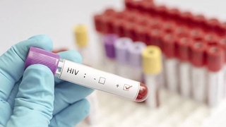 Oʻzbekistonda OITS bilan kasallangan qancha bemor borligi maʼlum qilindi