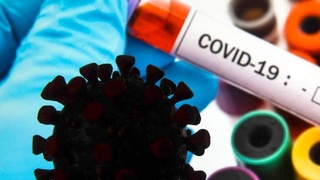 СOVID-19: Dunyoda pandemiya toʼlqini kundan kun kuchaymoqda