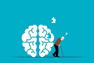 Олимлар Альцгеймер касаллигидан 70 фоизгача ҳимоя қилувчи ген вариантини топди