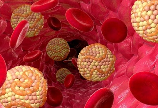 Organizmdagi xolesterin miqdorini qanday kamaytirish mumkin?