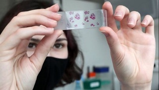 “Omikron”dan soʻng hosil boʻlgan immunitetning himoya darajasi 10 oy oʻtgach, 36 foizga tushadi