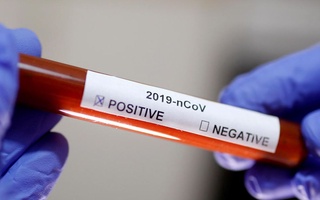 COVID-19 in Uzbekistan: 2620 cases