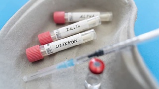 Pandemiya chekinmoqdami? Dunyoda kasallanish koʻrsatkichlari 30 foizga pasaydi