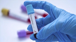 Кунлик кўрсаткичлар бироз пасайди, аммо хавотирлар камайгани йўқ